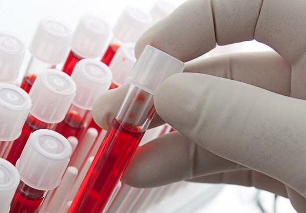 анализ крови после употребления алкоголя